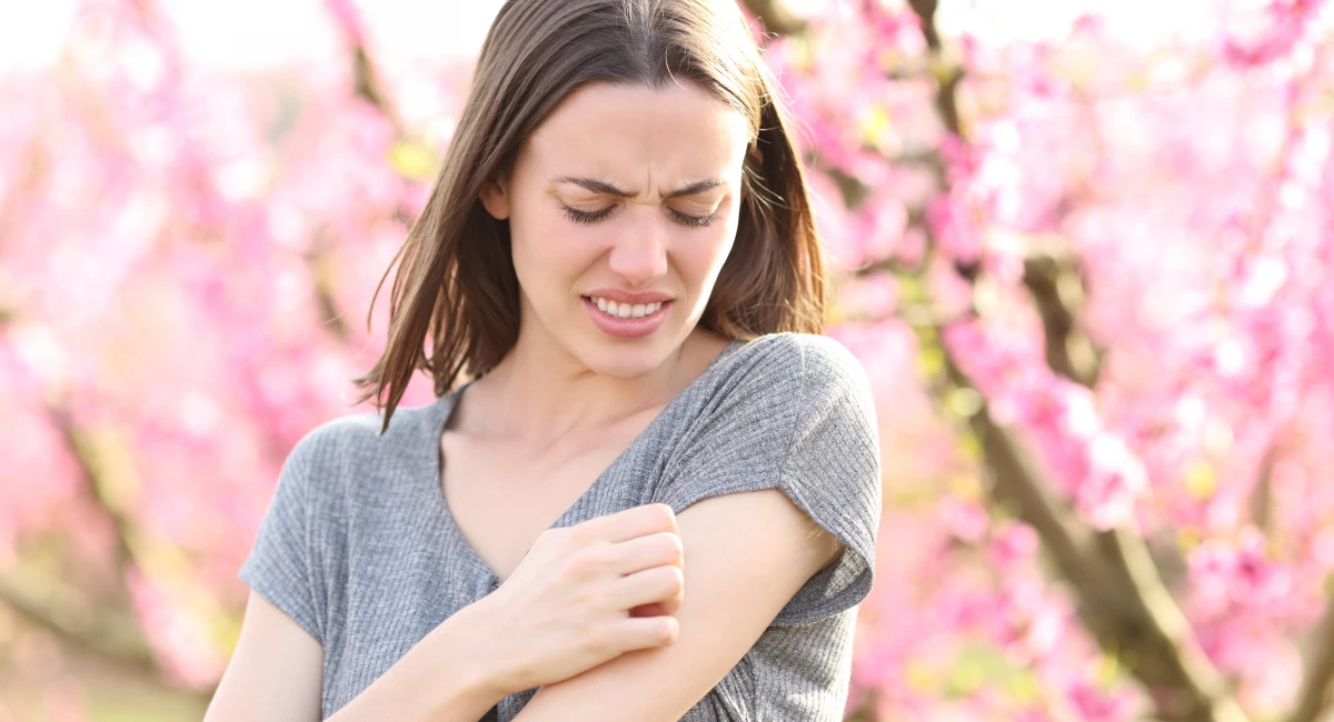 A woman scratching her arm after a painful insect bite