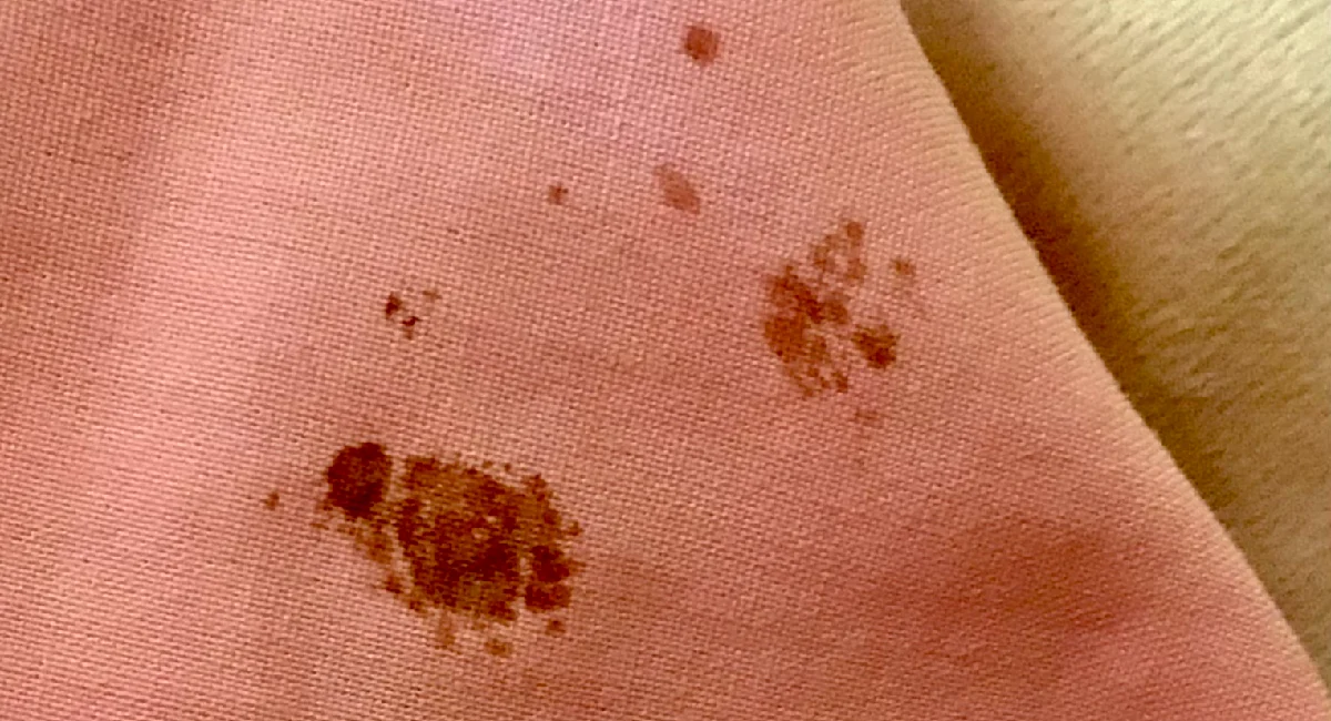 reddish brown stains on bedsheet